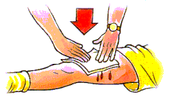 1. Compressione diretta