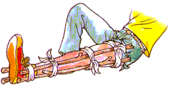 2. Immobilizzare la parte lesa con stecche